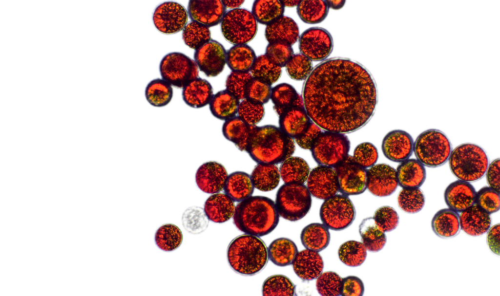 Oxidative Stress: How Natural Astaxanthin Helps Support Balance